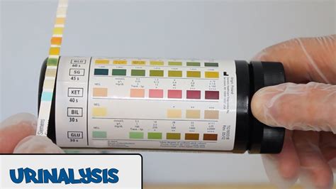 dropping urine strip test with pipette|reading urine dipstick test results.